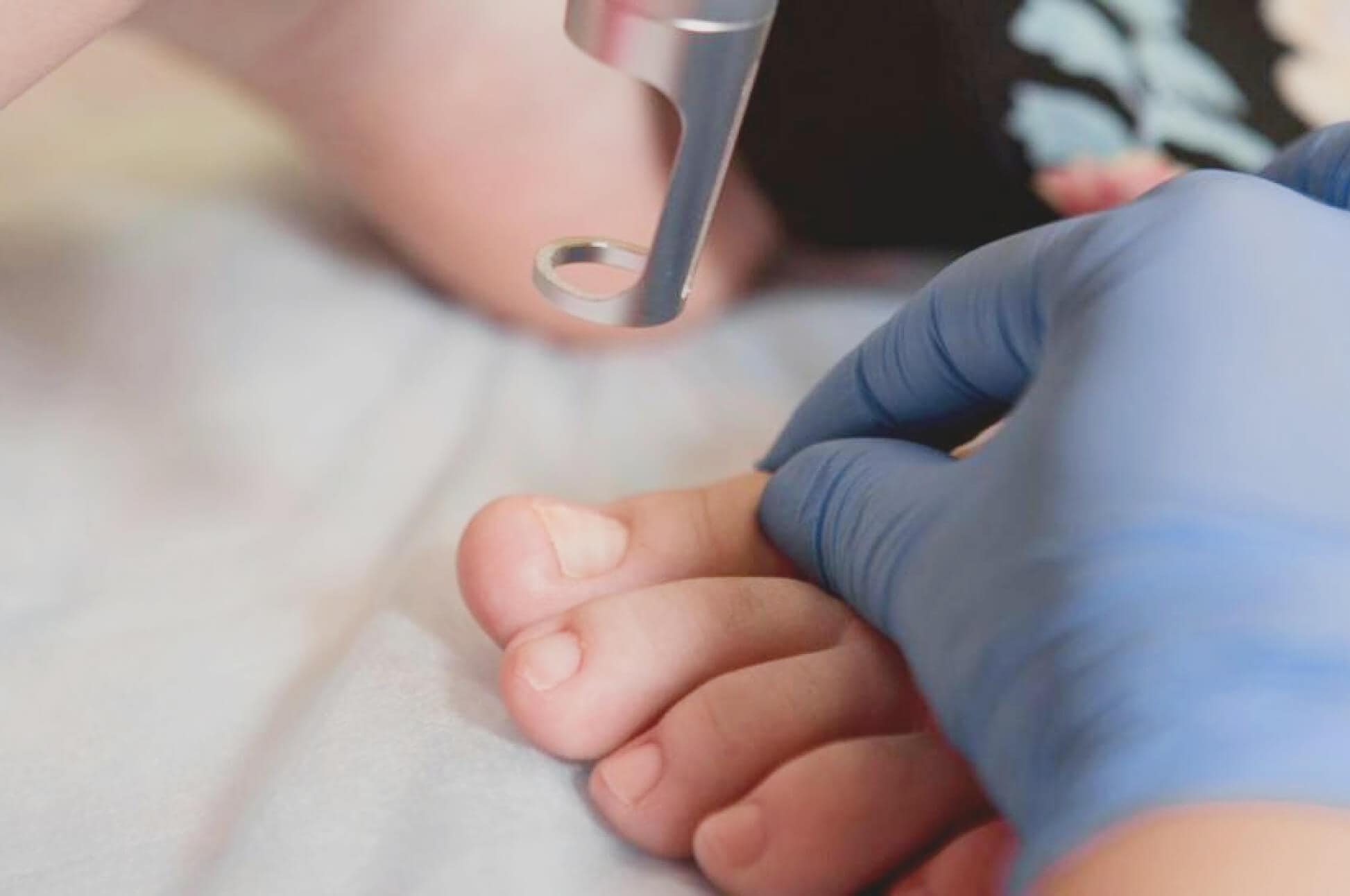 Fungal Nail Infection - St Michaels Clinic Fungal Nail Infection - St Michaels Clinic