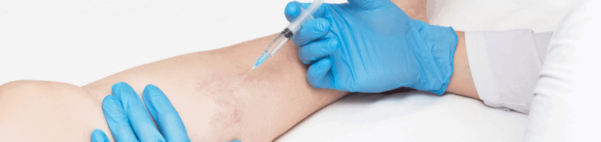 Sclerotherapy injection