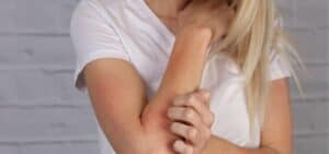 Skin allergies Shrewsbury